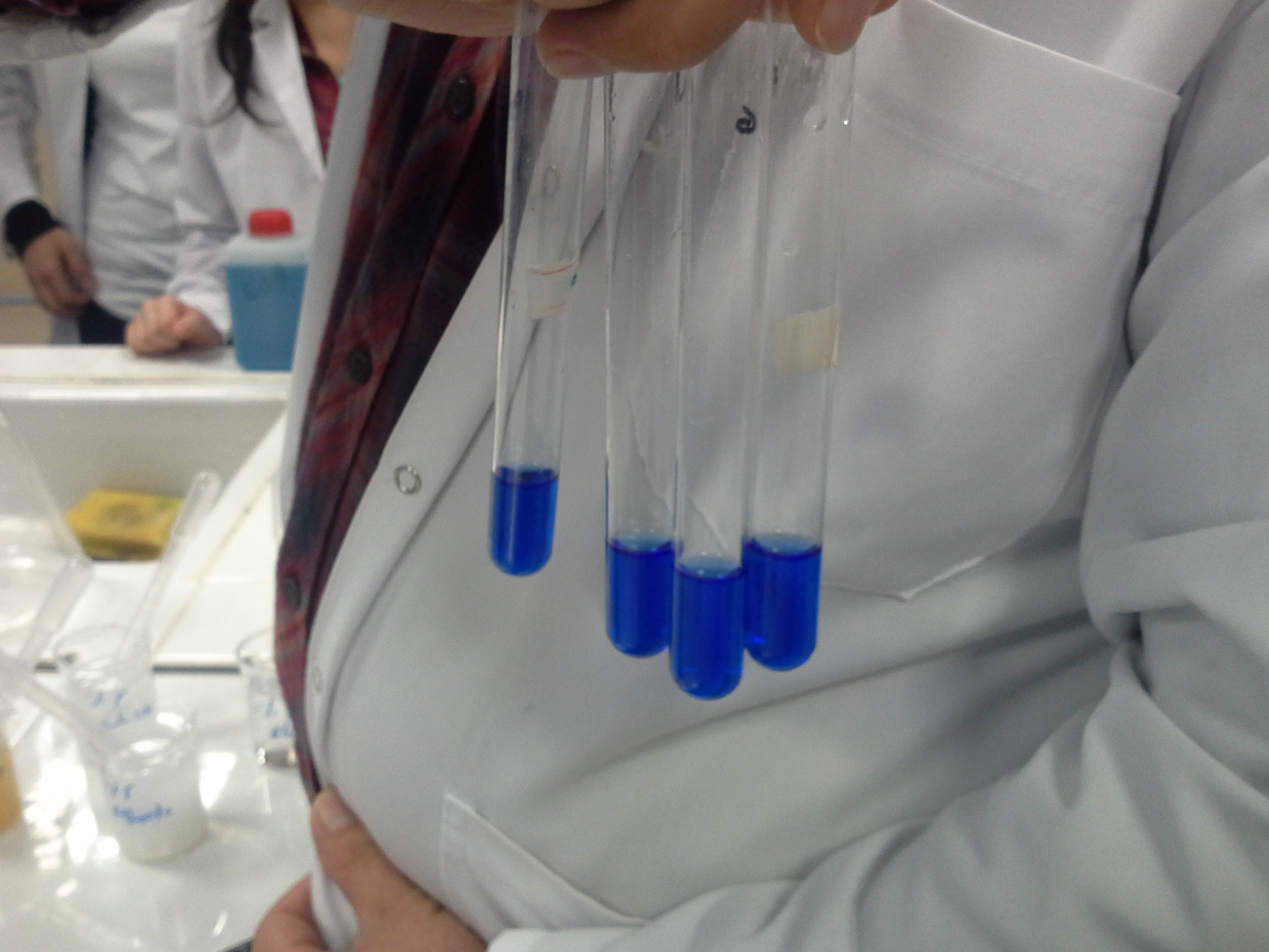 İdrarda Hemoglobin, Eritrosit, Lökosit, Epitel İdrarda Hemoglobin, Eritrosit, Lökosit, Epitel